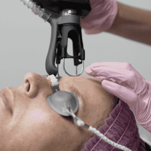 Tetra Pro Cool Peel Co2 Treatment