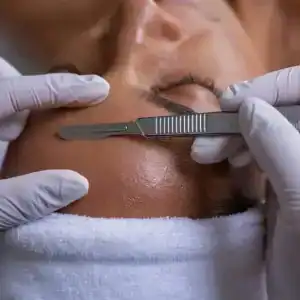 Dermaplanning