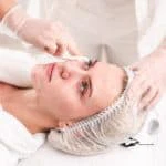 Acne Scar Treatment scaled