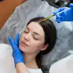 Dermal Fillers