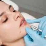 Dermal Fillers